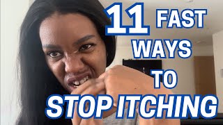 How to STOP Itching Dyshidrotic ECZEMA at Night 11 FAST Remedies [upl. by Riggall166]