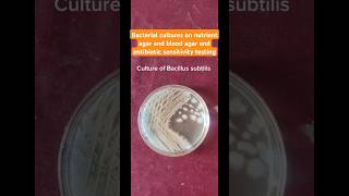 Bacillus subtilis Enterococcus fecalis Desulfovibrio cultures and colonies health microbiology [upl. by Aiket]