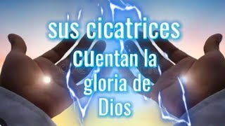 Sus cicatrices cuentan la gloria de Dios [upl. by Haseena]