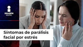 Dolor de mandíbula y otros síntomas te revelan que podrías tener parálisis facial por estrés [upl. by Annaj979]