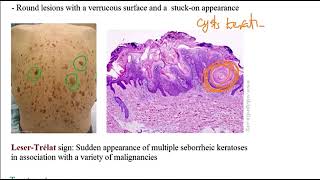 USMLE ACE Video 192 Skin Disorders Overview [upl. by Niels]