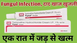 Tyza Cream Uses  Terbinafine Cream  दाद खाज खुजली Fungul Infection जड़ से ठीक करे [upl. by Ybbob]