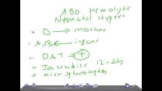 QUICK PEDIATRICS Criteria to diagnose ABO incompatibility [upl. by Odragde]