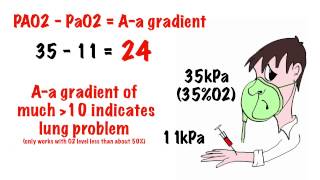 Arterial blood gas interpretation in 5 min [upl. by Nennahs59]