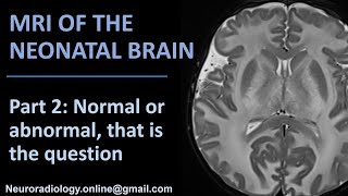 MRI of the neonatal brain part 2 Normal or abnormal that is the question [upl. by Alfredo896]