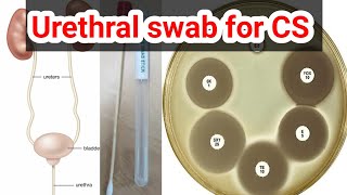 urethral swab for culture and sensitivity CS test urduhindi [upl. by Fennell]