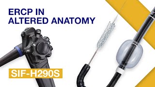 Mastering the Single Balloon Enteroscope SIFH290S  Gastroenterology [upl. by Enahc]