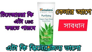 Himalaya neem face wash review ll কেনার আগে সাবধানll [upl. by Sacken224]