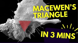 Macewens Triangle 📐  In THREE MINUTES [upl. by Ladnek]