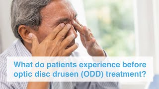 What do patients experience before optic disc drusen ODD treatment [upl. by Yur]