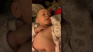 Example of Retractions Belly Breathing and Tachypnea in Infant [upl. by Gannie]