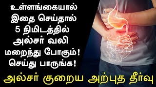 அல்சர் குணமாக வீட்டு வைத்தியம்  Ulcer Treatment in Tamil Ulcer Symptoms in Tamil Tamil Health Tips [upl. by Bremble]