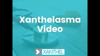 Xanthelasma How To Easily Remove Them With Xanthel ® Suprisingly Affordable [upl. by Idnyl247]