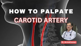 Carotid artery palpation method  Dr Arvind Kumar [upl. by Cyd]