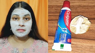 Colgate toothpaste for face whitening  Lemon and colgate  Colgate Face Par Lagane Se Kya Hota Hai [upl. by Droffig64]