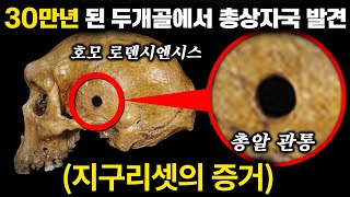 30만년 전 두개골에서 총알 자국 발견 지구리셋의 증거 총이 아니면 불가능  미스터리 1월 몰아보기 [upl. by Ernestus]