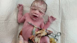 Cutest Newborn baby covered in Vernix just after birth viral baby cute [upl. by Gniw]