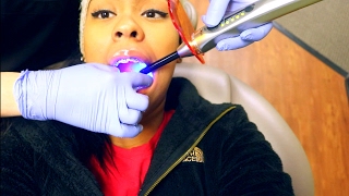 ✗ Braces Update Vlog 2  Tooth Extractions  Spacers  More ✗ [upl. by Cudlip]