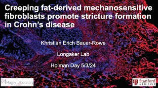 Creeping fatderived mechanosensitive fibroblasts promote stricture formation in Crohns Disease [upl. by Tomkin]