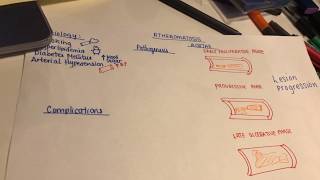 Pathology of an atherosclerotic plaque in the aorta Atheromatosis Aortae [upl. by Edmunda]