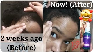 I tried Hollywood Hair Bars growth serum for 2 weeks amp THIS happened 🤯 Hollywoodhairbar [upl. by Esmerelda]