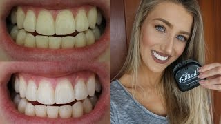 How I Whitened My Teeth At Home  Smile Brilliant Giveaway ♡ [upl. by Rehpotsrik]