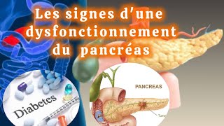 Pourquoi prendre soin de votre pancréas   Signes de dysfonctionnement à ne pas ignorer [upl. by Ecirtram748]