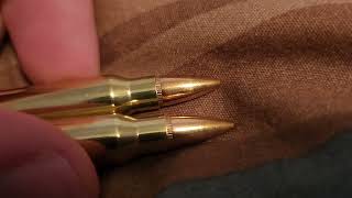 what are Bullet candalierstriations [upl. by Cleasta]