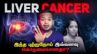 இந்த அறிகுறிகள் உங்களுக்கு இருக்கா  Liver Cancer  கல்லீரல் புற்றுநோய்  MrGK [upl. by Rehoptsirhc]