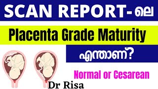 Placenta Grade in Scan Report Malayalam  Placenta Position [upl. by Leasim888]