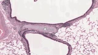 trachea and lungm4v [upl. by Grefer]