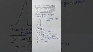 WATER HAMMER OR COLLAPSING OR CORRIGANS PULSE [upl. by Ciaphus]