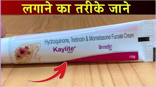 Kaylite Cream Uses Side Effects Price and Review Hindi [upl. by Zoha]