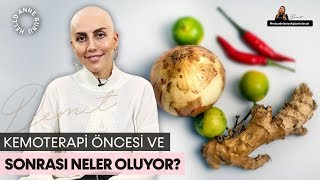 Kemoterapi Öncesi ve Sonrası Neler Oluyor [upl. by Rabi783]