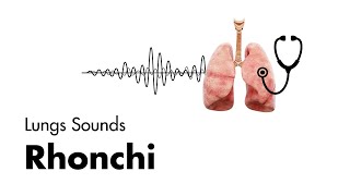 Rhonchi  Lung Sounds  Medzcool [upl. by Esmerolda997]