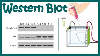 Western blot  Western blotting protocol  Application of Western Blot  Limitations of Western blot [upl. by Neyuq]