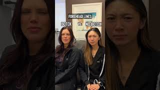 Botox vs No Botox—can you spot the difference laserclinique botox medspa botoxandfillers [upl. by Eberta]