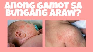 ANONG GAMOT SA BUNGANG ARAW NI BABY  MOMMY JAEN [upl. by Billat]