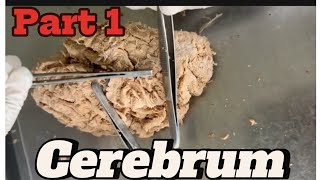 Gyri and sulci of cerebrum part 1 mbbsanatomy nepalforyou viral medicalhacks [upl. by Keefer]