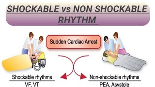 SHOCKABLE vs NON SHOCKABLE RHYTHM [upl. by Hnamik993]