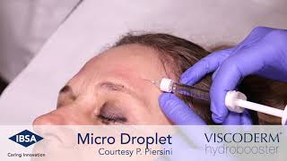 Viscoderm Hydrobooster  Microdroplet Technique Forehead Area [upl. by Alekal]