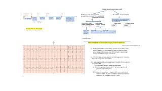 STEMI part 3 Approach to all MIs and troponin grades  subtle STEMI cases OMI  LV thrombus [upl. by Ardnasella]