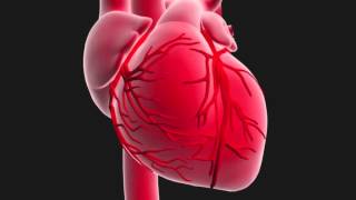 Questce quun infarctus du myocarde [upl. by Syxela]