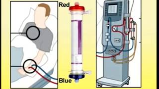 Setting Up of Dialysis Machine [upl. by Steere]