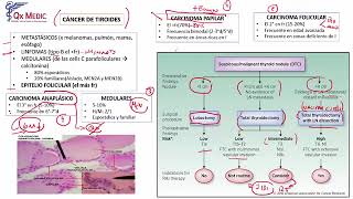 6 RM19 1V D A 3 ENDOCRINOLOG A CANCER DE TIROIDES [upl. by Weisberg]