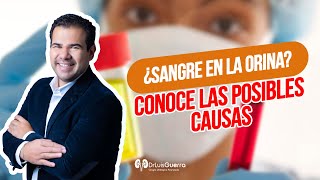 ¿Qué hacer si me sale sangre al orinar Causas y enfermedades asociadas  Medicina Clara [upl. by Atsylak]