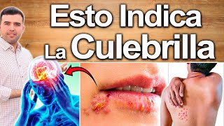 Esto Indican Las Aftas Y Culebrilla  Enfermedades Que Produce El Herpes O Fuegos Y Cómo Eliminarlas [upl. by Ylrehs]