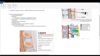 quotHowToquot Guide  Paraspinous Lumbar Puncture  Spinal Anesthesia Lateral Position [upl. by Nylinej]