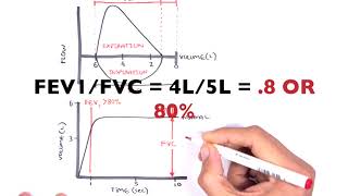 Understanding Spirometry  Normal Obstructive vs Restrictive [upl. by Eeramit]