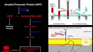 Prions  Mechanisms and Theories of Alzheimers Disease Amyloid amp Tau [upl. by Haveman]